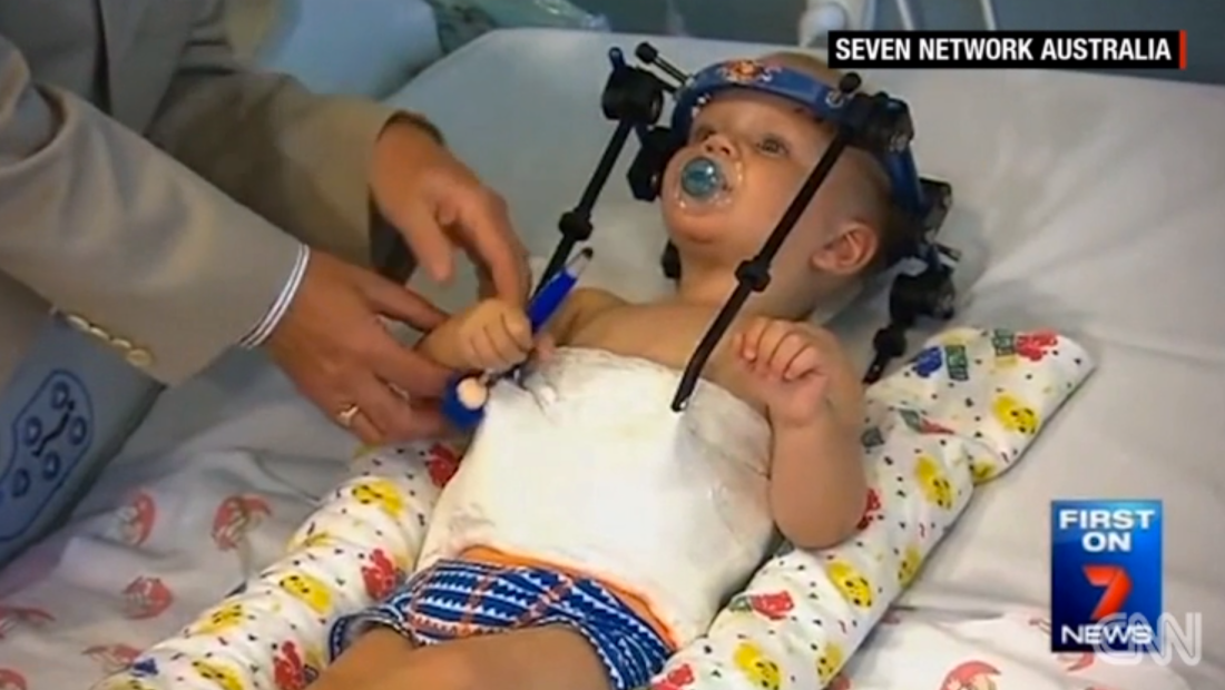 Niño bebé decapitado internamente Australia