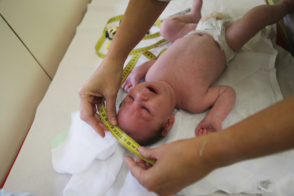 La Dr. Vanessa Van Der Linden, la neuropediatra que alertó por primera vez de la crisis por microcefalia en Brasil, mide el craneo   de un bebé afectado por el padecimiento en Recife. (Crédito:  Mario Tama/Getty Images).