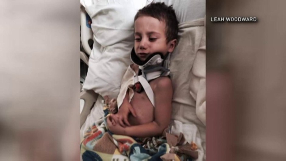 niño-accidente-killian-gonzalez