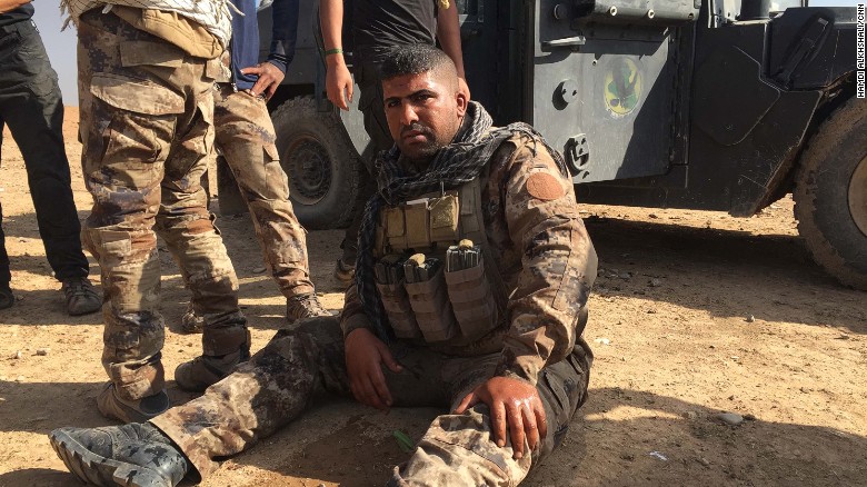 Este soldado iraquí, que resultó herido, aseguró que un carro bomba suicida de ISIS explotó cerca de su Humvee.