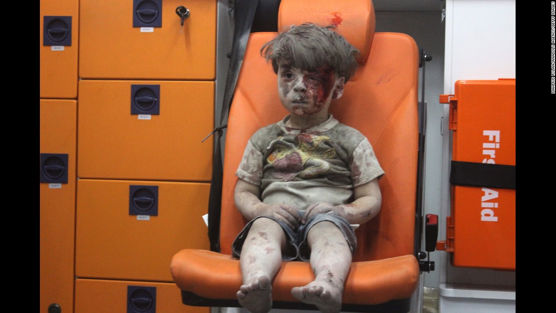 Agosto 17: Esta imagen, un fotograma de un video publicado por el Centro de Medios de Aleppo, muestra a un niño en una ambulancia tras un ataque aéreo en Aleppo, Siria. Les tomó a los socorristas casi una hora sacar el menor, identificado como Omran Daqneesh, de los escombros, le dijo un activista a CNN. El ataque destruyó su hogar, en donde vivía con sus padres y dos hermanos.