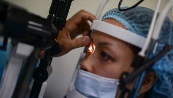 Consejos del mejor oftalmólogo para cuidar tus ojos