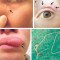 Una paciente de 32 años tomó selfies de un bulto que se movió alrededor de su rostro.