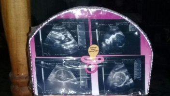 La familia mostró imágenes de la ecografía durante el embarazo. (Crédito: fotografía cedida por el diario Crónica).