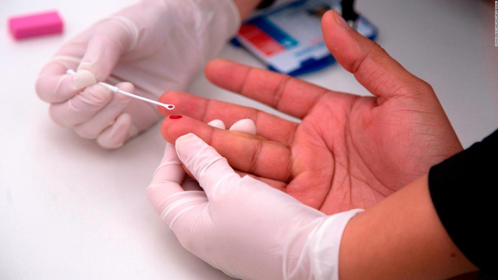 ¿Cuáles son los retos del VIH/sida en América Latina?