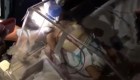 Activista: asisten a bebé con respirador manual por apagón en Venezuela