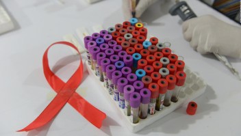 Avance contra el virus del VIH