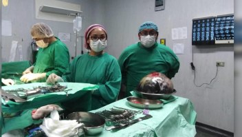 Médicos peruanos extraen tumor de 15 kg