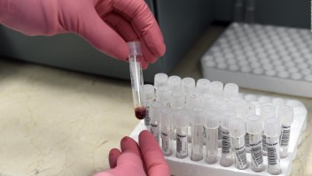Arqueología viral le sigue el rastro al VIH