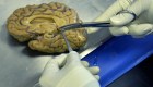 Crean mini-cerebros y los implantan a ratas de laboratorio