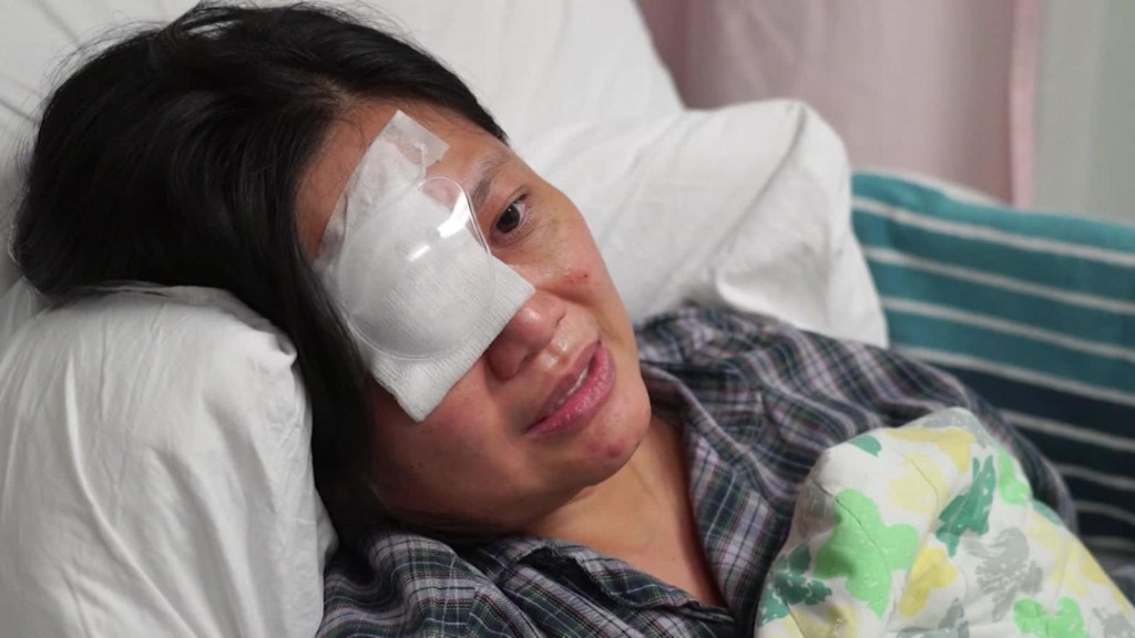 Periodista pierde la vista de un ojo por bala de goma