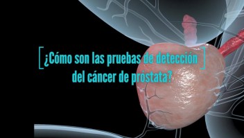 La detección temprana del cáncer de próstata salva vidas