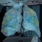 Mira el ataque del covid-19 a los pulmones en 3D