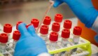 Fraude en pruebas de detección de coronavirus en México