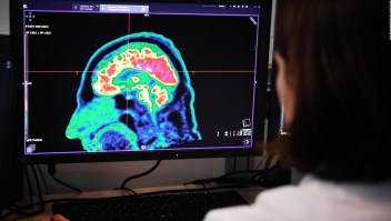 ¿Podría el cerebro ser inmune al cáncer?