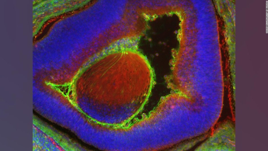 Los científicos crearon un embrión de ratón que es 4% humano: el nivel más alto de células humanas en un animal hasta ahora