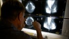 EE.UU.: pandemia retrasó exámenes de cáncer