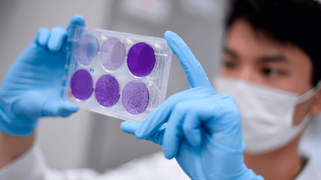 Las superbacterias resistentes a los antibióticos causaron más muertes que el VIH y la malaria en 2019, según estudio