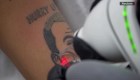 Estudio de Londres elimina tatuajes de Kanye West
