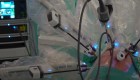 Innovador trasplante pulmonar robótico en España
